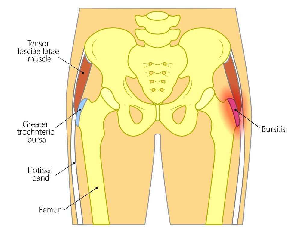 Hip Replacement Surgeon in Delhi